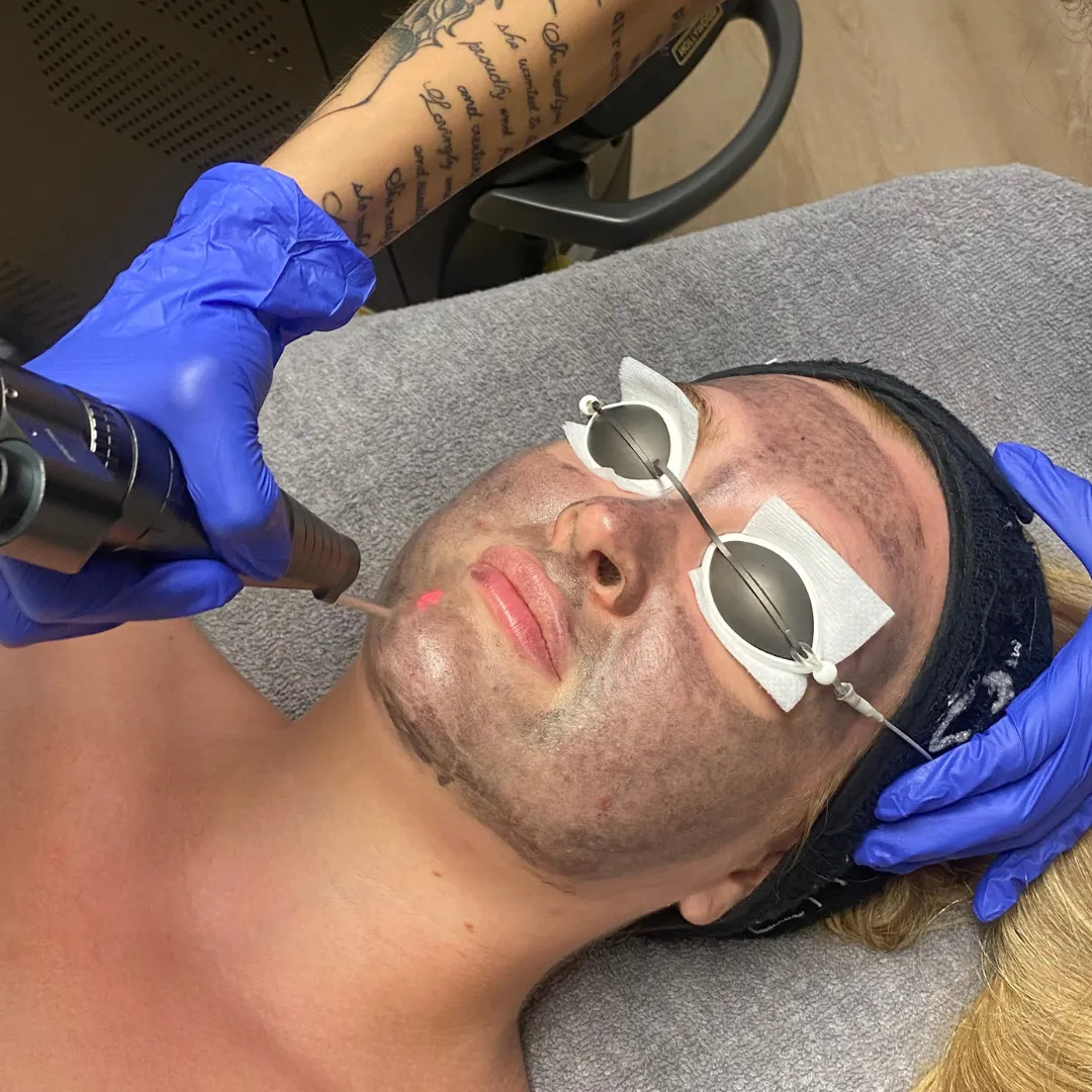 M Coup d'Éclat Protocol