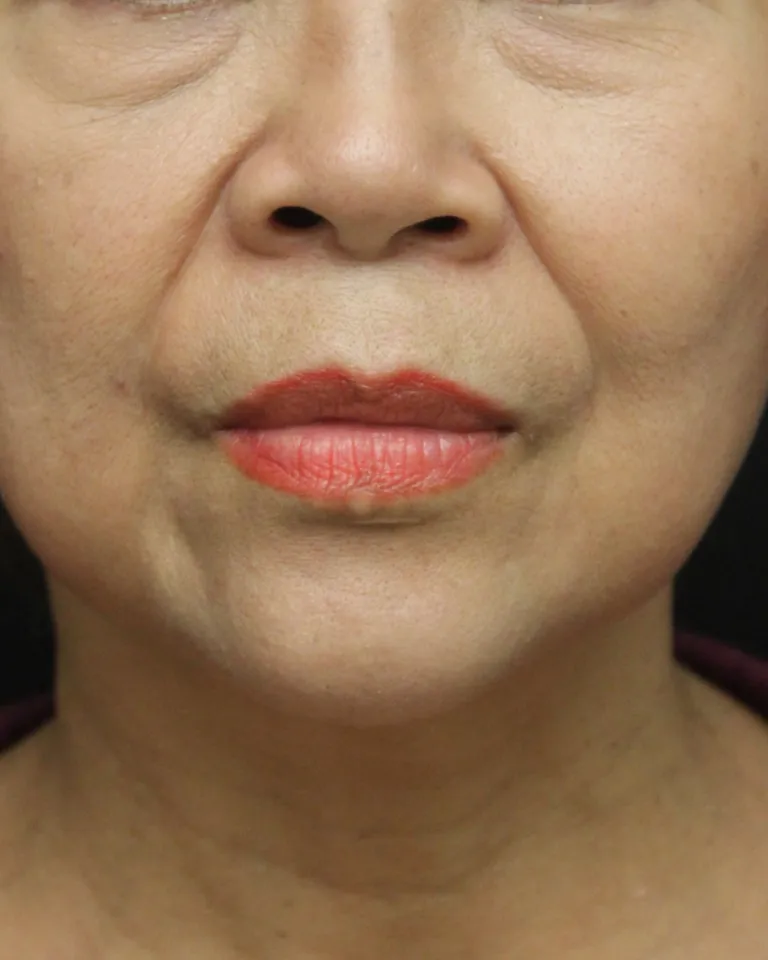 Sans titre (Publication Instagram (45)) (1)