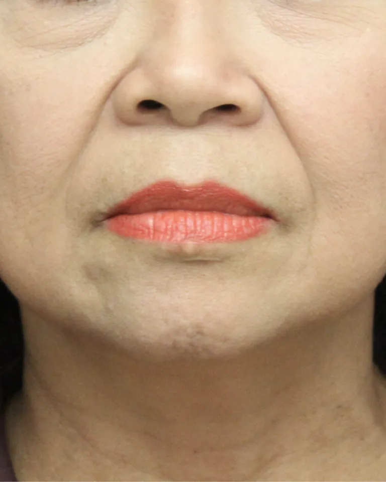 Sans titre (Publication Instagram (45))