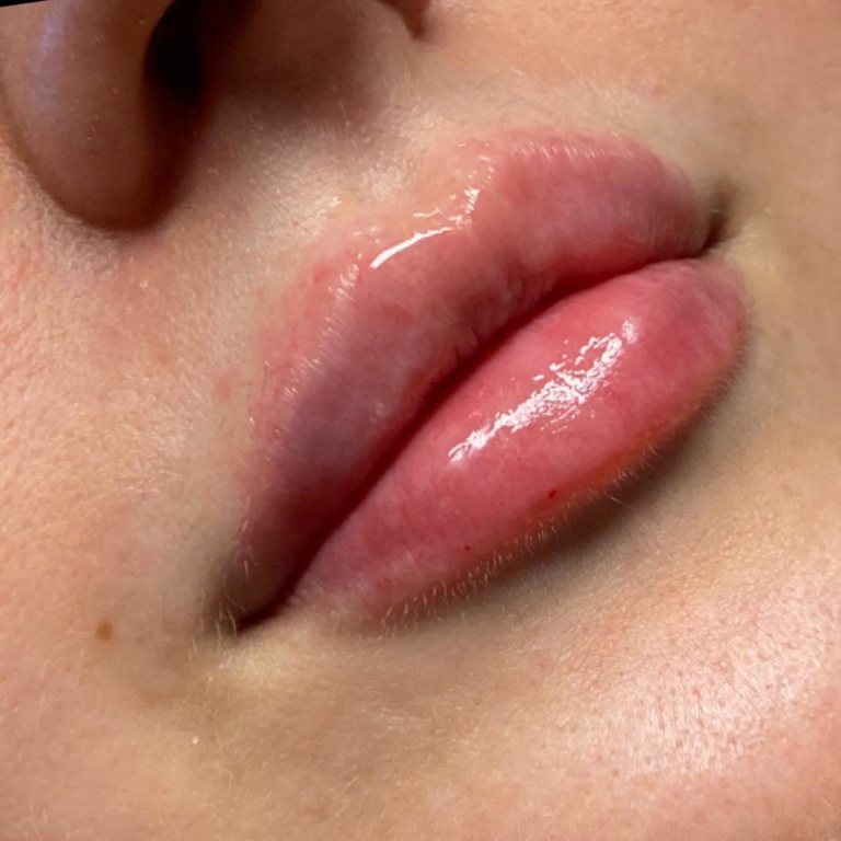 CARRÉ (6)