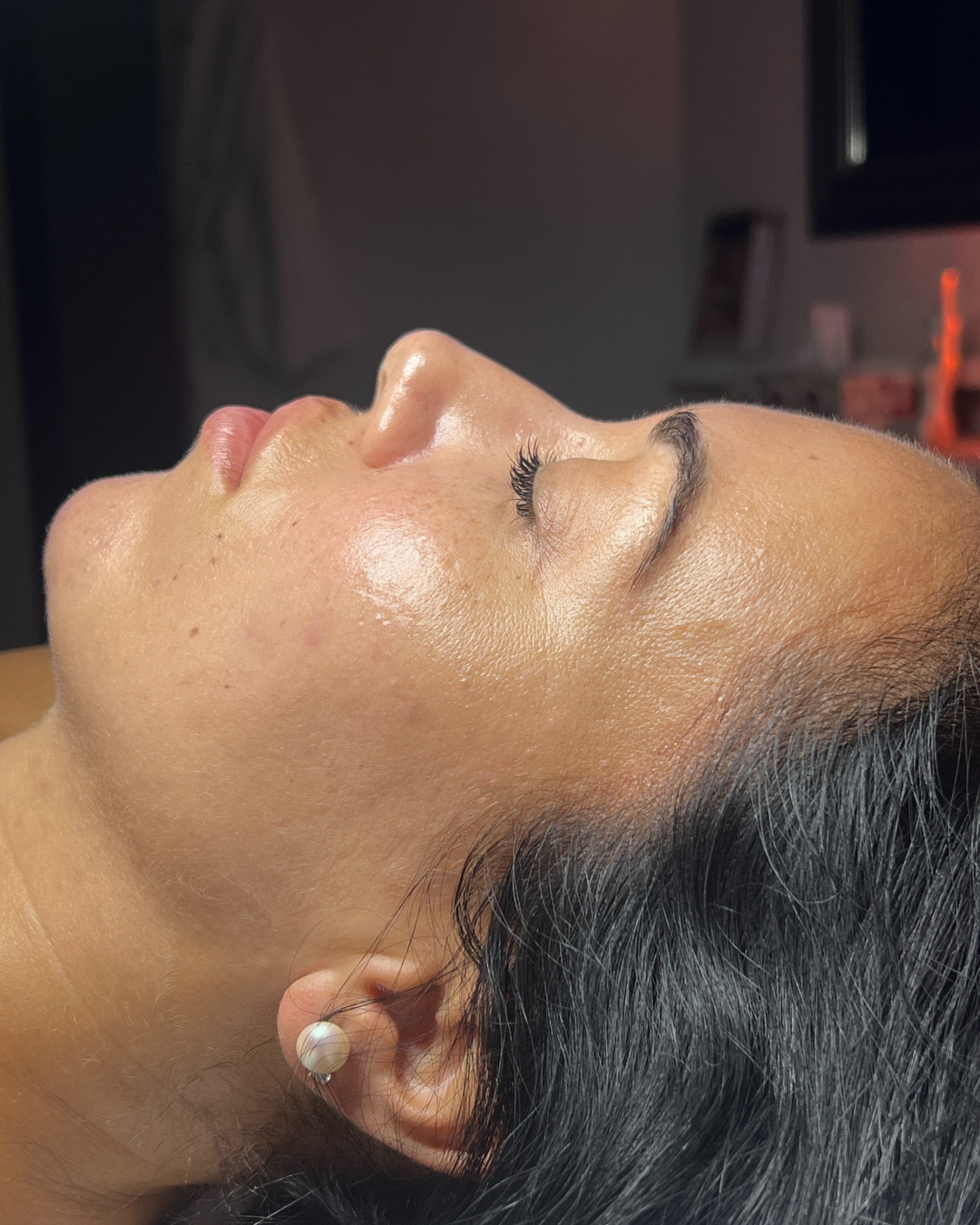 M Hydra Glow Protocol - Après